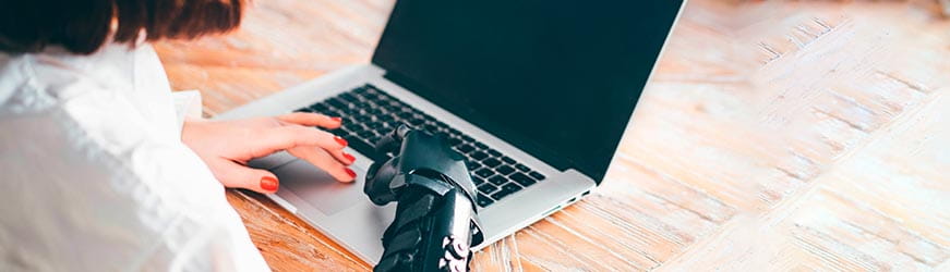 Une femme, avec une prothèse au bras droit, travaille sur son ordinateur